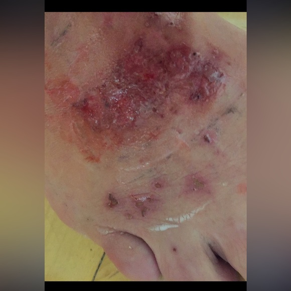 🛍️ Lg 4 oz Miracle Healing Balm, SUNDAY NIGHT SALE!! #momma #elevatedskincare - Picture 4 of 16